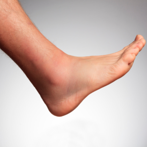 Podiatrist in Glen Cove that accepts Medicaid